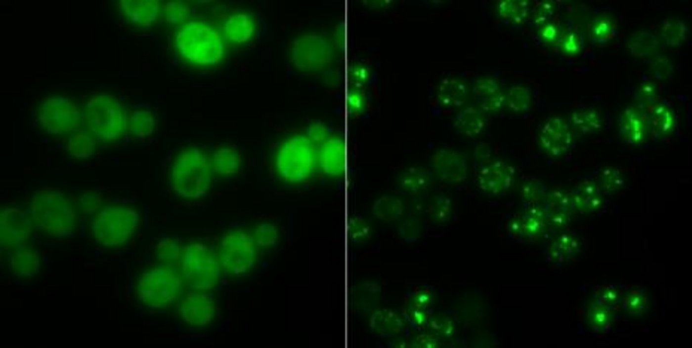 Hefezellen ohne Proteinaggregate (links) und solche mit (hell leuchtende Punkte): In Hungerzeiten dienen solche Klumpen als Zwischenlager für Proteine. (Bild Gruppe Matthias Peter/ETH Zürich)