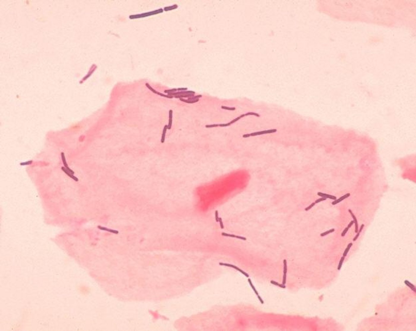 Bei der Agroscope kommen zu Forschungszwecken Milchsäurebakterien zum Einsatz. (Bild: PD-USGov-HHS-CDC)