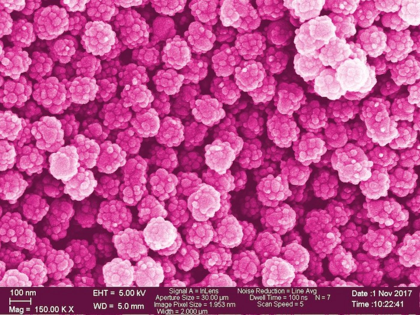 Auf dieser nachträglich eingefärbten Aufnahme eines Elektronenmikroskops sehen die Nanoplastik-Teilchen noch ganz schön aus. (Bild Empa / ETH)