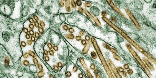 Elektronenmikroskopische Aufnahme von A/H5N1 (Virus ist golden angefärbt). (Bild: Cynthia Goldsmith)