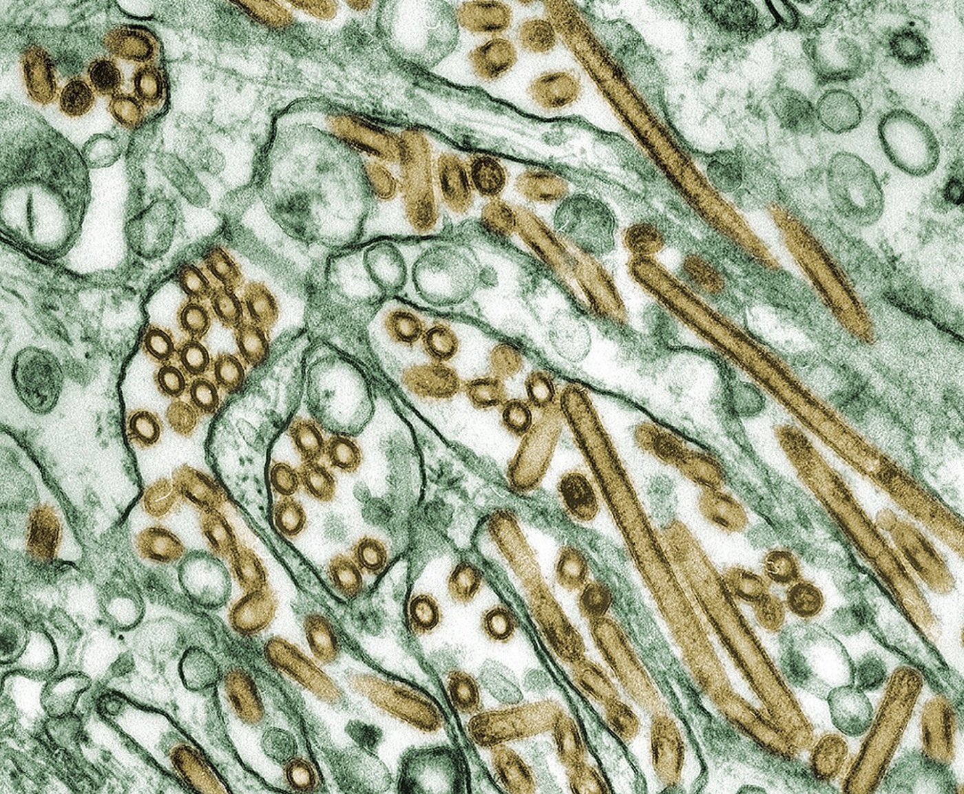 Elektronenmikroskopische Aufnahme von A/H5N1 (Virus ist golden angefärbt). (Bild: Cynthia Goldsmith)