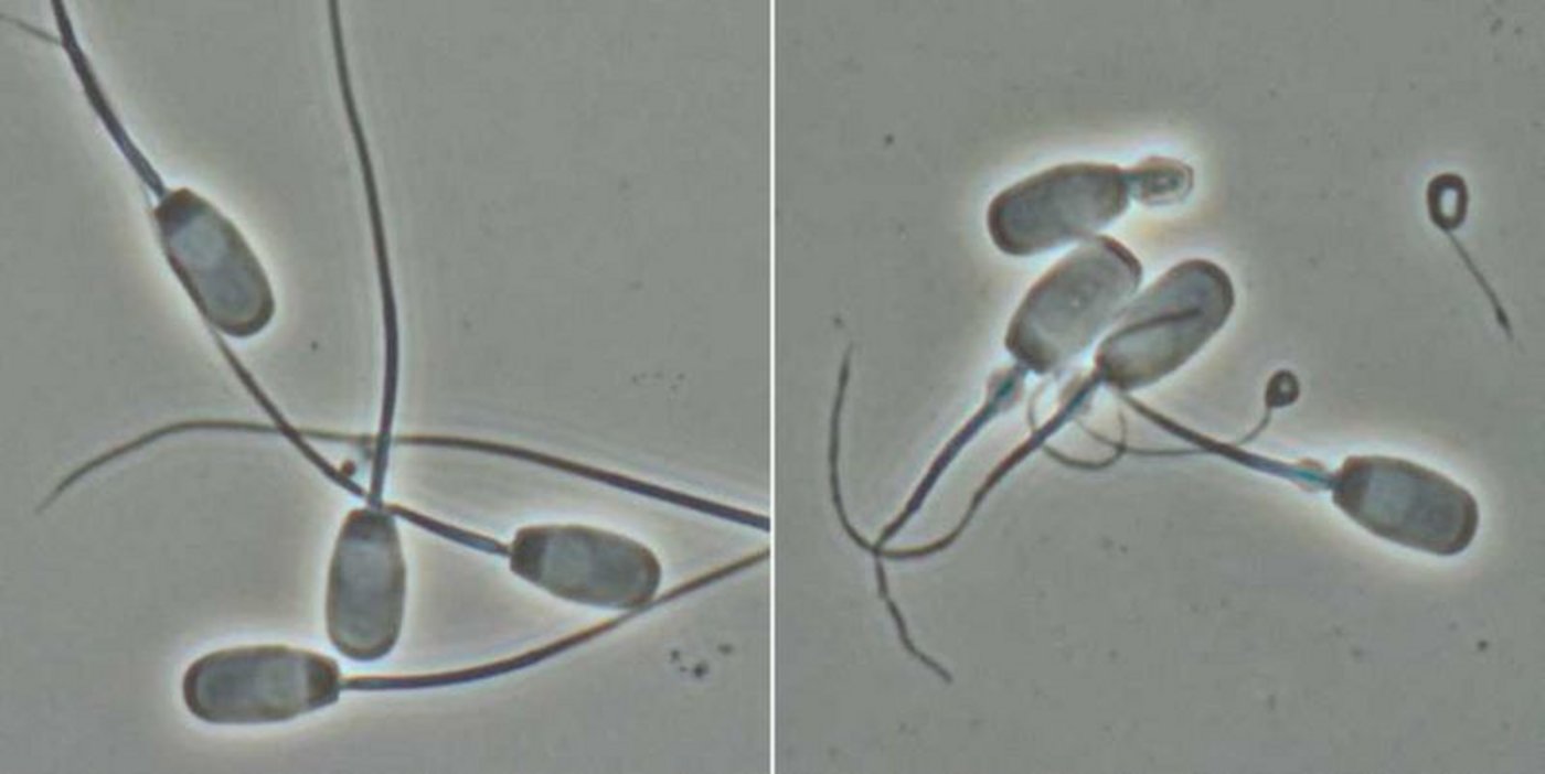 Normale Spermien (l.) und solche mit gekrümmten Schwänzen, die sich nicht fortbewegen können. (Bild Hubert Pausch/ETH Zürich)