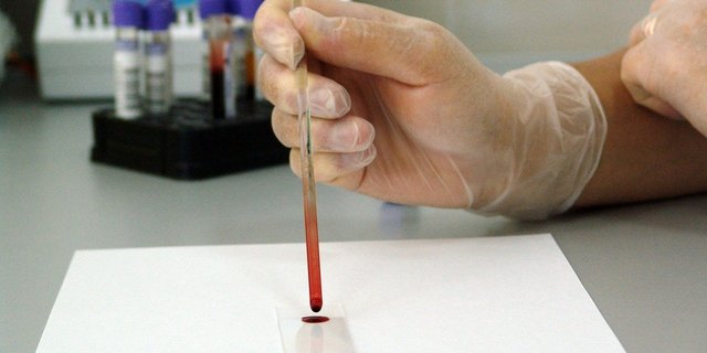 Parlamentarier wünschen sich mehr Unterstützung für Methoden der Forschung ohne Tierversuche und den Ausstieg aus belastenden Experimenten mit Tieren. (Symbolbild PublicDomainPictures / Pixabay)