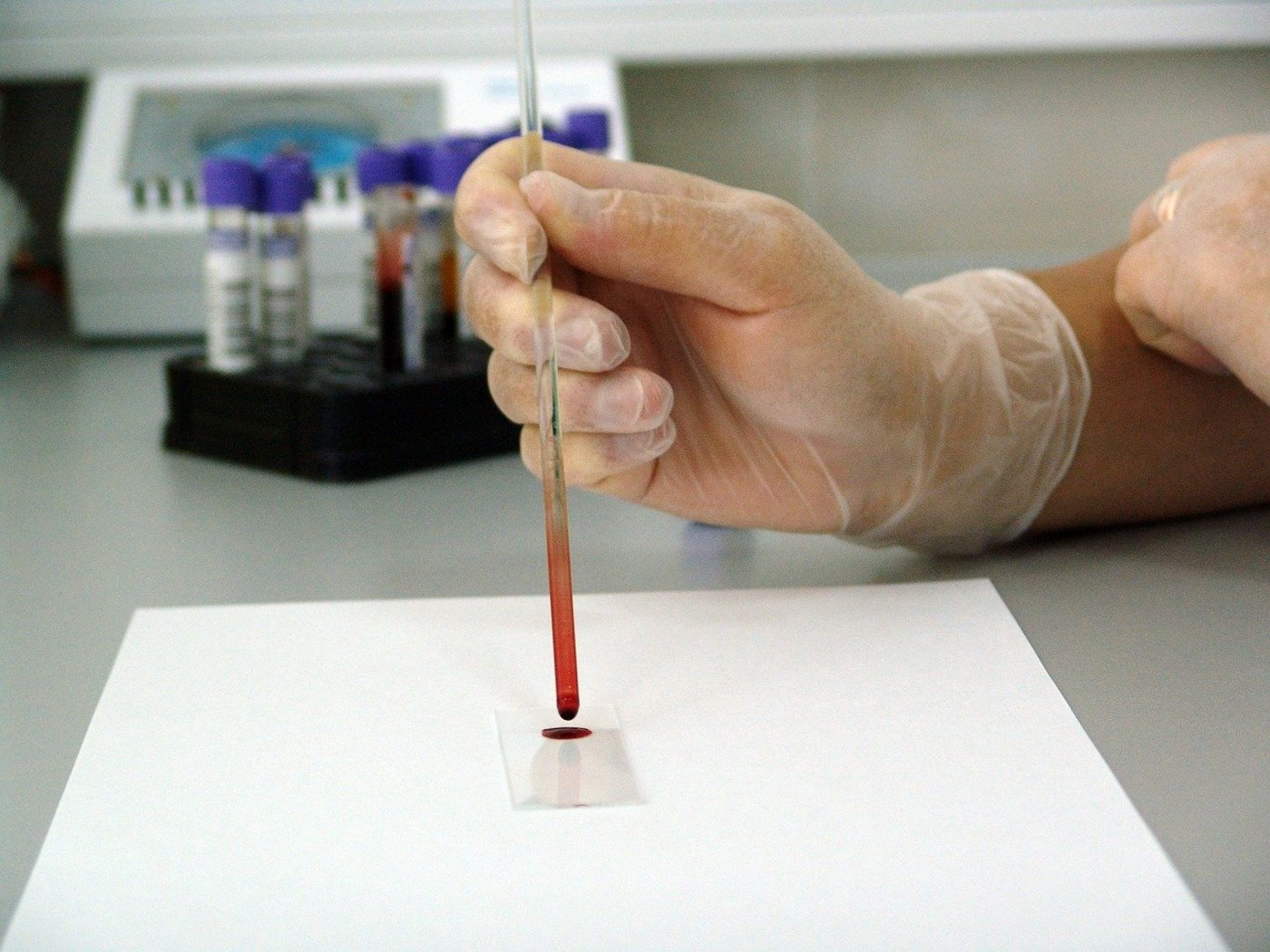 Parlamentarier wünschen sich mehr Unterstützung für Methoden der Forschung ohne Tierversuche und den Ausstieg aus belastenden Experimenten mit Tieren. (Symbolbild PublicDomainPictures / Pixabay)