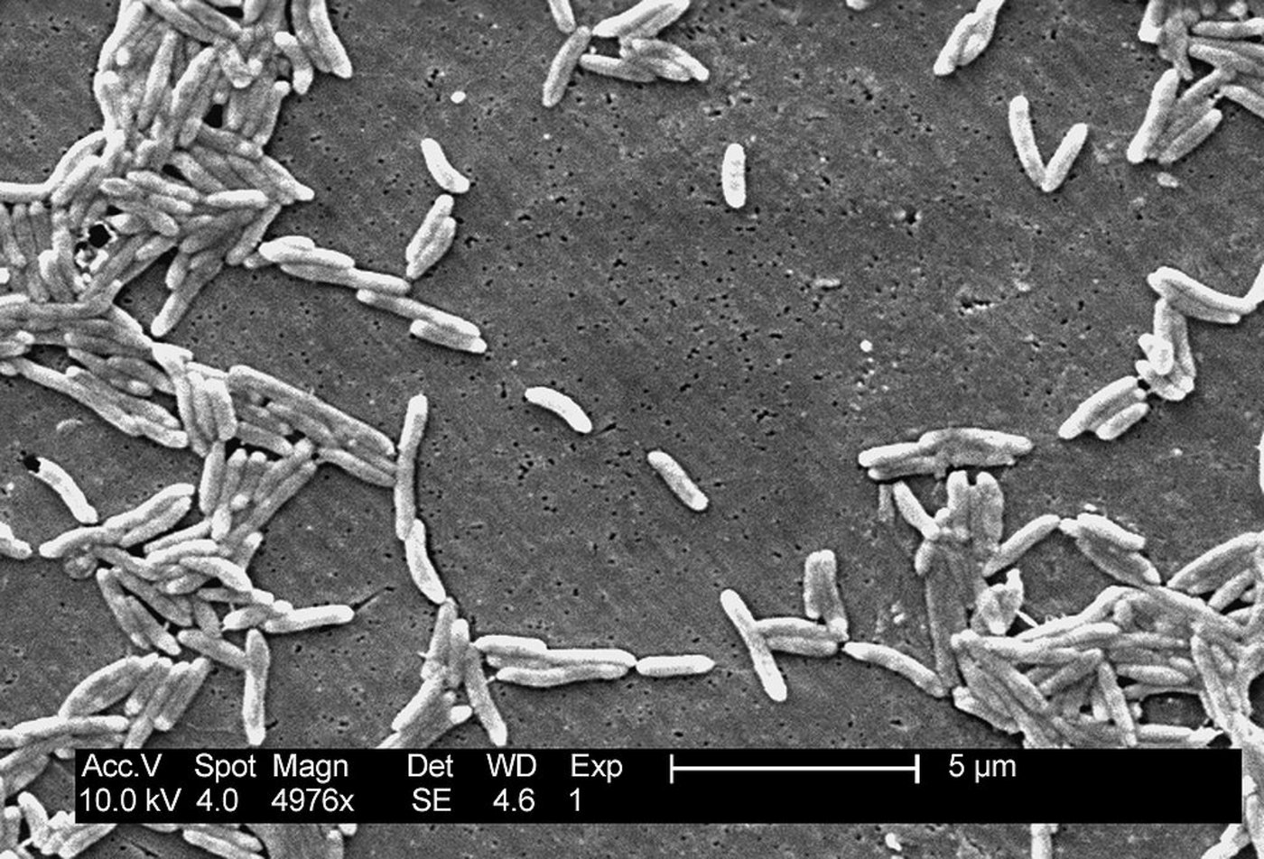 Campylobacter, hier die Unterart Fetus. (Bild Janice Carr)
