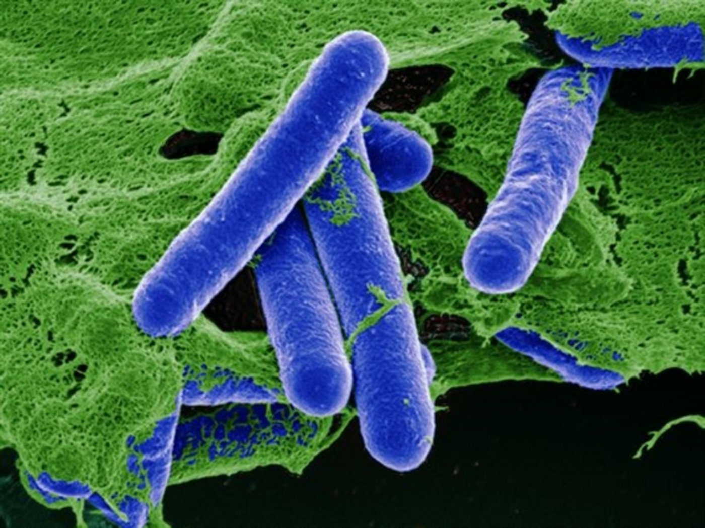 Clostridium botulinum kann akute Vergiftungen bei Tieren auslösen, die zum schnellen Tod führen. (Bild pa) 