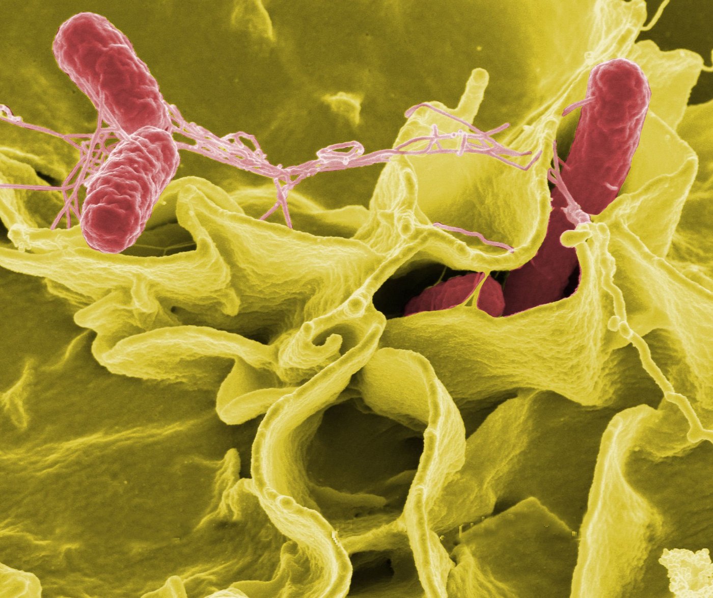 Sekundärelektronenmikroskopaufnahme von Salmonellen (rot eingefärbt). (Bild NIAID)