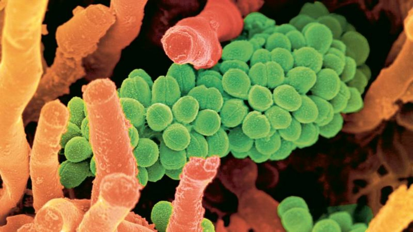 Aktive Bioböden: Zwei Arten von Bodenbakterien. (Foto: Fotolia sciencerfvideo.mov)